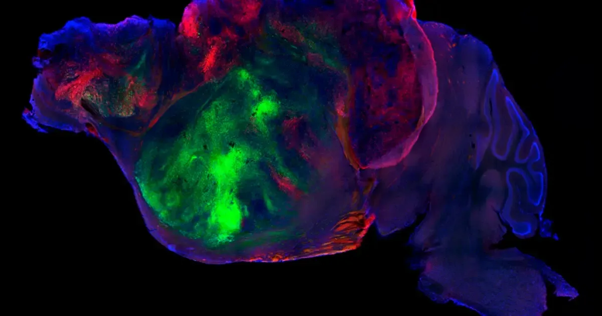 Células humanas permitem investigar doenças cerebrais em camundongos