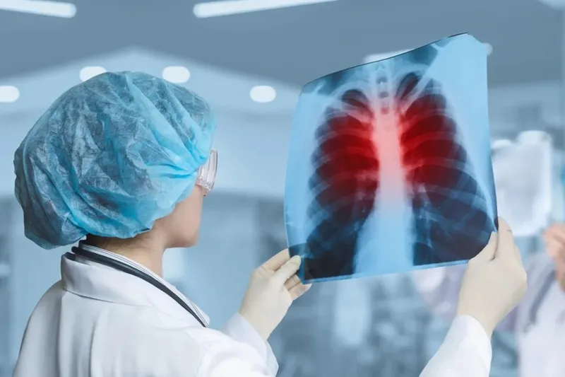 CCJ muda proposta para evitar novas despesas com hipertensão pulmonar