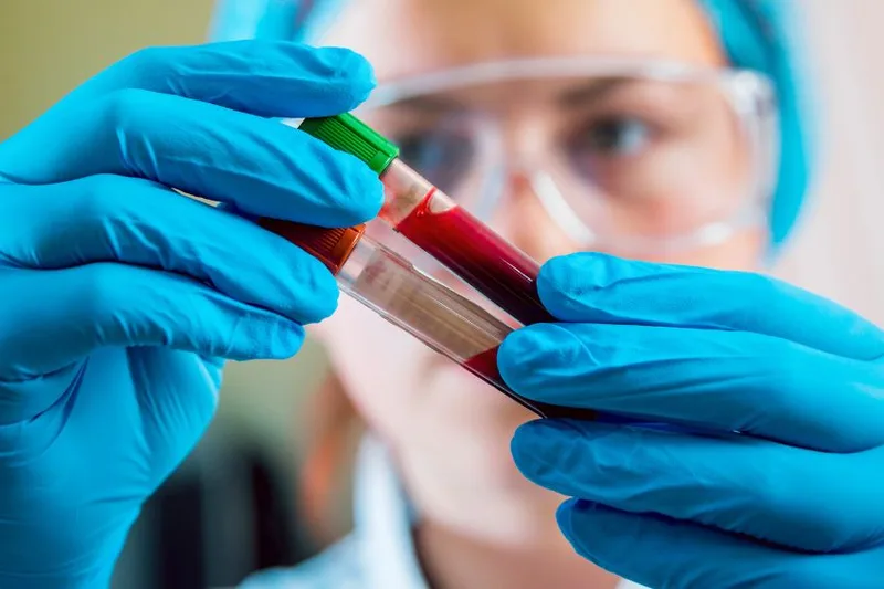 Novo exame do Einstein procura sinais de câncer em uma única coleta de sangue